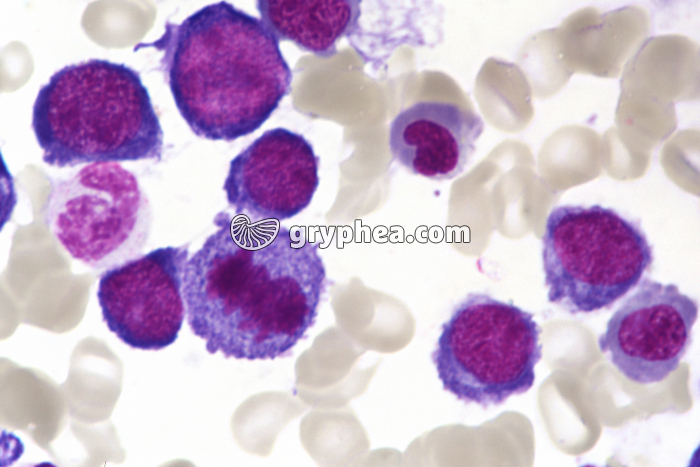 Moelle osseuse humaine cellules en mitose - métaphase x400 - gryphea.com